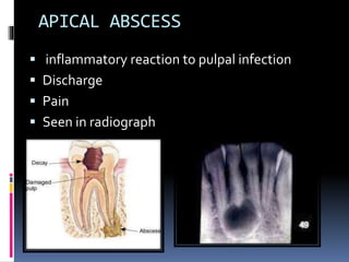 CASE HISTORY IN ENDODONTICS.pptx