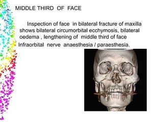 MIDDLE THIRD OF FACE
Inspection of face in bilateral fracture of maxilla
shows bilateral circumorbital ecchymosis, bilateral
oedema , lengthening of middle third of face
Infraorbital nerve anaesthesia / paraesthesia.
 
