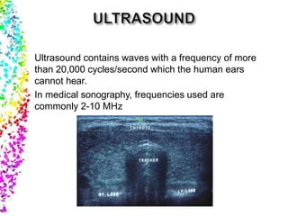 Ultrasound contains waves with a frequency of more
than 20,000 cycles/second which the human ears
cannot hear.
In medical sonography, frequencies used are
commonly 2-10 MHz
 