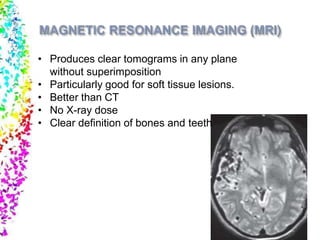 • Produces clear tomograms in any plane
without superimposition
• Particularly good for soft tissue lesions.
• Better than CT
• No X-ray dose
• Clear definition of bones and teeth
 
