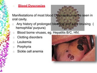 Blood Dyscrasias
Manifestations of most blood Dyscrasias may be seen in
oral cavity.
Any history of prolonged bleeding and easy bruising (
hemophilia/ purpura)
Blood borne viruses, eg. Hepatitis B/C, HIV,
Clotting disorders
Leukemia
Porphyria
Sickle cell anemia
 