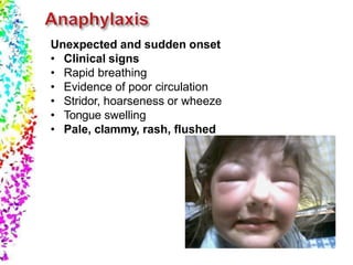 Unexpected and sudden onset
• Clinical signs
• Rapid breathing
• Evidence of poor circulation
• Stridor, hoarseness or wheeze
• Tongue swelling
• Pale, clammy, rash, flushed
 