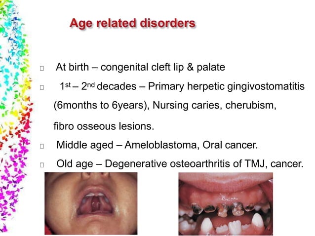 case-history-in-omfs-rnr-ppt