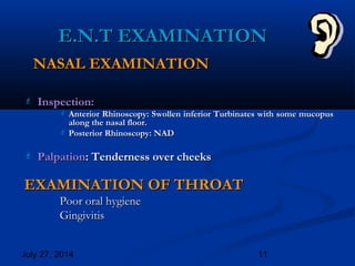 July 27, 2014 11
E.N.T EXAMINATIONE.N.T EXAMINATION
NASAL EXAMINATIONNASAL EXAMINATION
 Inspection:Inspection:
 Anterior Rhinoscopy: Swollen inferior Turbinates with some mucopusAnterior Rhinoscopy: Swollen inferior Turbinates with some mucopus
along the nasal floor.along the nasal floor.
 Posterior Rhinoscopy: NADPosterior Rhinoscopy: NAD
 PalpationPalpation: Tenderness over cheeks: Tenderness over cheeks
EXAMINATION OF THROATEXAMINATION OF THROAT
Poor oral hygienePoor oral hygiene
GingivitisGingivitis
 