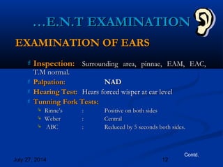 July 27, 2014 12
EXAMINATION OF EARSEXAMINATION OF EARS
 Inspection:Inspection: Surrounding area, pinnae, EAM, EAC,Surrounding area, pinnae, EAM, EAC,
T.M normal.T.M normal.
 Palpation:Palpation: NADNAD
 Hearing Test:Hearing Test: Hears forced wisper at ear levelHears forced wisper at ear level
 Tunning Fork Tests:Tunning Fork Tests:
 Rinne’sRinne’s :: Positive on both sidesPositive on both sides
 WeberWeber :: CentralCentral
 ABCABC :: Reduced by 5 seconds both sides.Reduced by 5 seconds both sides.
Contd.
……E.N.T EXAMINATIONE.N.T EXAMINATION
 