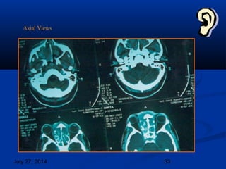 July 27, 2014 33
Axial Views
 
