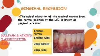 Periodontal Case History | PPTX