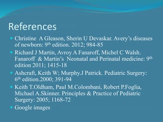 References
 Christine A Gleason, Sherin U Devaskar. Avery’s diseases
of newborn: 9th edition. 2012; 984-85
 Richard J Martin, Avroy A Fanaroff, Michel C Walsh.
Fanaroff & Martin’s Neonatal and Perinatal medicine: 9th
edition 2011; 1415-18
 Ashcraft, Keith W; Murphy.J Patrick. Pediatric Surgery:
6th edition.2000; 391-94
 Keith T.Oldham, Paul M.Colombani, Robert P.Foglia,
Michael A.Skinner. Principles & Practice of Pediatric
Surgery: 2005; 1168-72
 Google images
 