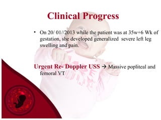 Clinical Progress
• On 20/ 01//2013 while the patient was at 35w+6 Wk of
gestation, she developed generalized severe left leg
swelling and pain.
Urgent Re- Doppler USS  Massive popliteal and
femoral VT
 