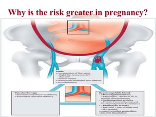 Why is the risk greater in pregnancy?
 