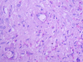 Case Liver Abscess. | PPT