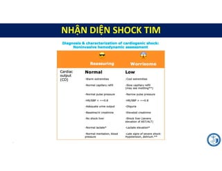 Case lâm sàng về sHock.pdf