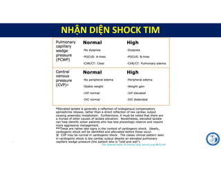 Case lâm sàng về sHock.pdf