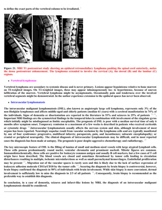 Case record...Epidural secondary CNS lymphoma