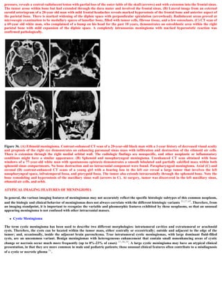 pressure, reveals a central radiolucent lesion with partial loss of the outer table of the skull (arrows) and with extension into the frontal sinus.
The tumor arose within bone but had extended through the dura mater and involved the frontal sinus. (B) Lateral image from an external
carotid arteriogram of a 20-year old man with mild frontal headaches reveals marked hyperostosis of the frontal bone and anterior aspect of
the parietal bone. There is marked widening of the diploic space with perpendicular spiculation (arrowhead). Radiolucent areas proved at
microscopic examination to be medullary spaces of lamellar bone, filled with tumor cells, fibrous tissue, and a few osteoclasts. (C) CT scan of
a 69-year old white man, who complained of a bump on his head for the past 10 years, demonstrates an osteoblastic area within the right
parietal bone with mild expansion of the diploic space. A completely intraosseous meningioma with marked hyperostotic reaction was
confirmed pathologically.
Figure 36. (A) Ethmoid meningioma. Contrast-enhanced CT scan of a 20-year-old black man with a 1-year history of decreased visual acuity
and proptosis of the right eye demonstrates an enhancing paranasal sinus mass with infiltration and destruction of the ethmoid air cells.
There is extension through the right medial orbital wall. The radiologic findings are nonspecific, and other neoplastic or inflammatory
conditions might have a similar appearance. (B) Sphenoid and nasopharyngeal meningioma. Unenhanced CT scan obtained with bone
windows of a 77-year-old white man with spontaneous epistaxis demonstrates a smooth lobulated and partially calcified mass within both
sphenoid sinus compartments. No bone destruction and no intracranial component were found. Parapharyngeal meningioma. Axial (C) and
coronal (D) contrast-enhanced CT scans of a young girl with a hearing loss in the left ear reveal a large tumor that involves the left
nasopharyngeal space, infratemporal fossa, and pterygoid fossa. The tumor also extends intracranially through the sphenoid bone. Note the
bone remodeling and hyperostosis of the maxillary sinus wall (arrows in C). At surgery, tumor was discovered in the left maxillary sinus,
ethmoid air cells, and orbit.
ATYPICAL IMAGING FEATURES OF MENINGIOMA
In general, the various imaging features of meningiomas may not accurately reflect the specific histologic subtypes of this common neoplasm,
and the biologic and clinical behavior of meningiomas does not always correlate with the different histologic variants 33,37,49. Therefore, from
an imaging standpoint, it is important to recognize the variable and pleomorphic features exhibited by these neoplasms, so that an unusual
appearing meningioma is not confused with other intracranial masses.
 Cystic Meningioma
The term cystic meningioma has been used to describe two different morphologies: intratumoral cavities and extratumoral or arachnoid
cysts. Therefore, the cysts can be located within the tumor mass, either centrally or eccentrically; outside and adjacent to the edge of the
tumor; and, occasionally, inside the adjacent brain parenchyma. True intratumoral cystic meningiomas, with large dominant fluid-filled
cysts, are an uncommon variant. Benign meningiomas with heterogeneous enhancement that contain small nonenhancing areas of cystic
change or necrosis occur much more frequently (up to 8%-23% of cases) 37,38,39. A large cystic meningioma may have an atypical clinical
presentation, in that they are more common in male and pediatric patients; these unusual clinical features often contribute to a misdiagnosis
of a cystic or necrotic glioma 51.
 