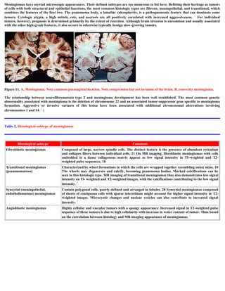 Meningiomas have myriad microscopic appearances. Their defined subtypes are too numerous to list here. Befitting their heritage as tumors
of cells with both structural and epithelial functions, the most common histologic types are fibrous, meningothelial, and transitional, which
combines the features of the first two. The psammoma body, a lamellar calcospherite, is a pathognomonic feature that can dominate some
tumors. Cytologic atypia, a high mitotic rate, and necrosis are all positively correlated with increased aggressiveness. 1 For individual
tumors, however, prognosis is determined primarily by the extent of resection. Although brain invasion is uncommon and usually associated
with the other high-grade features, it also occurs in otherwise typically benign slow-growing tumors.
Figure 11. A, Meningioma. Note common parasagittal location. Note compression but not invasion of the brain. B, convexity meningioma.
The relationship between neurofibromatosis type 2 and meningioma development has been well established. The most common genetic
abnormality associated with meningioma is the deletion of chromosome 22 and an associated tumor-suppressor gene specific to meningioma
formation. Aggressive or invasive variants of this lesion have been associated with additional chromosomal aberrations involving
chromosomes 1 and 14. 3 (
Table 2. Histological subtype of meningiomas
Histological subtype Comment
Fibroblastic meningiomas Composed of large, narrow spindle cells. The distinct feature is the presence of abundant reticulum
and collagen fibers between individual cells. 21 On MR imaging, fibroblastic meningiomas with cells
embedded in a dense collagenous matrix appear as low signal intensity in TI-weighted and T2-
weighted pulse sequences. 10
Transitional meningiomas
(psammomatous)
Characterized by whorl formations in which the cells are wrapped together resembling onion skins. 10
The whorls may degenerate and calcify, becoming psammoma bodies. Marked calcifications can be
seen in this histologic type. MR imaging of transitional meningiomas thus also demonstrates low signal
intensity on Tl- weighted and T2-weighted images, with the calcifications contributing to the low signal
intensity. 5
Syncytial (meningothelial,
endotheliomatous) meningiomas
Contain polygonal cells, poorly defined and arranged in lobules. 28 Syncytial meningiomas composed
of sheets of contiguous cells with sparse interstitium might account for higher signal intensity in T2-
weighted images. Microcystic changes and nuclear vesicles can also contribute to increased signal
intensity. 5
Angioblastic meningiomas Highly cellular and vascular tumors with a spongy appearance. Increased signal in T2-weighted pulse
sequence of these tumors is due to high cellularity with increase in water content of tumor. Thus based
on the correlation between histology and MR imaging appearance of meningiomas. 5
 