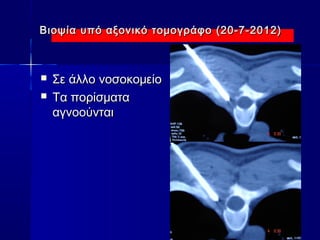 Βιοψία υπό αξονικό τομογράφο ((2200--77--22001122)) 
 ΣΣεε άάλλλλοο ννοοσσοοκκοομμεείίοο 
 ΤΤαα πποορρίίσσμμαατταα 
ααγγννοοοούύννττααιι 
 