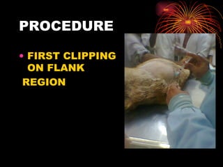 PROCEDURE FIRST CLIPPING ON FLANK REGION