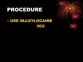 PROCEDURE USE INJ:XYLOCAINE 3CC