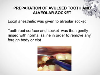 Case of avulsion in Permanent dentition.pptx