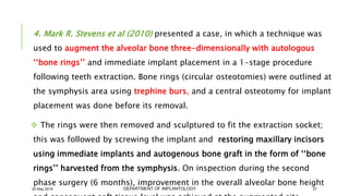 Case of immediate implant placement using bone ring technique | PPTX