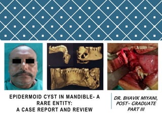 EPIDERMOID CYST IN MANDIBLE- A
RARE ENTITY:
A CASE REPORT AND REVIEW
DR. BHAVIK MIYANI,
POST- GRADUATE
PART III
 