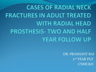 DR. PRASHANT RAI
2nd
YEAR PGT
CNMC&H
 