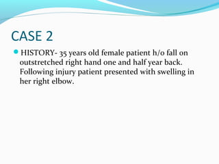 CASE 2
HISTORY- 35 years old female patient h/o fall on
outstretched right hand one and half year back.
Following injury patient presented with swelling in
her right elbow.
 