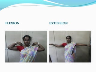 FLEXION EXTENSION
 