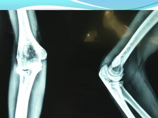 X-RAY
 