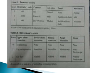 Case of rds | PPTX