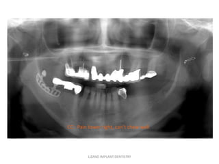 CC: Pain lower right, can’t chew well




         LIZANO IMPLANT DENTISTRY
 