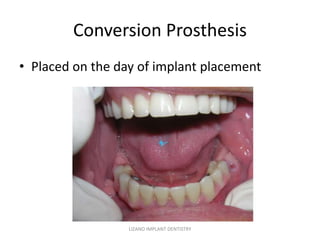 Dental Implant Case of the month: June, 2014 | PPTX