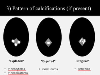 3) Pattern of calcifications (if present)
13
 