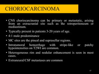 CHORIOCARCINOMA
• CNS choriocarcinoma can be primary or metastatic, arising
from an extracranial site such as the retroperitoneum or
mediastinum.
• Typically present in patients 3-20 years of age.
• 4:1 male predominance
• MC sites are the pineal and suprasellar regions.
• Intratumoral hemorrhage with stripe-like or patchy
hypointensities on T2WI are common.
• Heterogeneous rim and nodular enhancement is seen in most
cases.
• Extraneural/CSF metastases are common
17
 