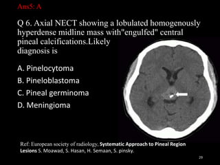 Ans5: A
Q 6. Axial NECT showing a lobulated homogenously
hyperdense midline mass with"engulfed" central
pineal calcifications.Likely
diagnosis is
A. Pinelocytoma
B. Pineloblastoma
C. Pineal germinoma
D. Meningioma
29
Ref: European society of radiology, Systematic Approach to Pineal Region
Lesions S. Moawad, S. Hasan, H. Semaan, S. pinsky.
 