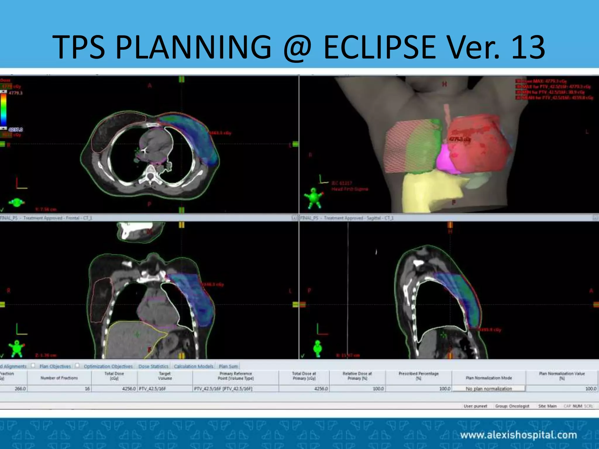 Case Based Early Breast Cancer- Role of Radiotherapy | PPTX