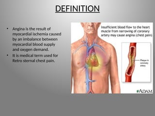 CASE PRESENTATION OF ANGINA PECTORIS FOR NURSING STUDENTS | PPTX