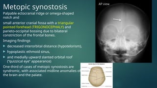 CASE PRESENTATIOn in Radiology SYntostosis | PPTX