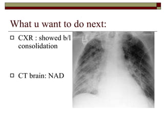 What u want to do next: CXR : showed b/l consolidation CT brain: NAD 