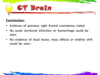 Conclusion:
• Evidence of previous right frontal craniotomy noted.
• No acute territorial infarction or hemorrhage could be
  seen.
• No evidence of focal lesion, mass effects or midline shift
  could be seen.
 