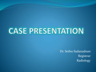 Dr. Sethu Sadanadnan
Registrar
Radiology
 