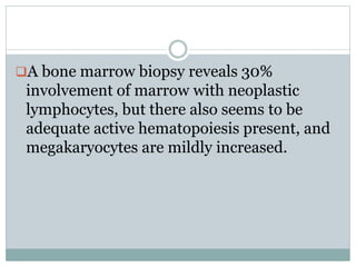 A bone marrow biopsy reveals 30%
involvement of marrow with neoplastic
lymphocytes, but there also seems to be
adequate active hematopoiesis present, and
megakaryocytes are mildly increased.
 