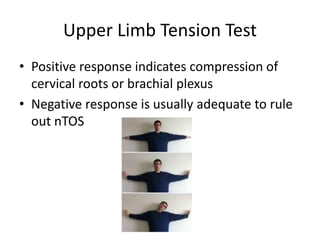 Tos Decompression Test Thoracic Outlet Syndrome | PPTX