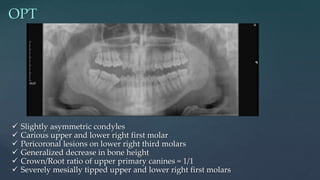 Condyles Opt Case presentation | PPTX