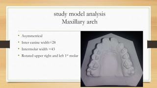 study model analysis
Maxillary arch
• Asymmetrical
• Inter canine width=28
• Intermolar width =43
• Rotated upper right and left 1st molar
 