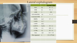 Lateral cephalogram
Normal Value
SNA 84 81 +- 3
SNB 81 78 +- 3
ANB 3 2-4
S-N/ANS-PNS 3.8 8 +- 3
Corrected ANB 3
MMPA 26.9 27 +- 3
UAFH 51.7
LAFH 68.2
LAFH % 56.8% 55 +- 2
U1/Mx 111 108 +- 6
L1/Mn 92 93 +- 6
IAA 128 133 +- 10
Wits Appraisal 2 0 + 1.77 mm
 