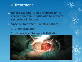  Treatment
 Before Staging: Blood transfusion to
correct anemia & antibiotic to prevent
secondary infection.
 Specific Treatment For this patient:
1. Chemoradiation
2. Ultraradical Surgery & Palliation
 