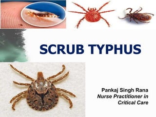 SCRUB TYPHUS
Pankaj Singh Rana
Nurse Practitioner in
Critical Care
 