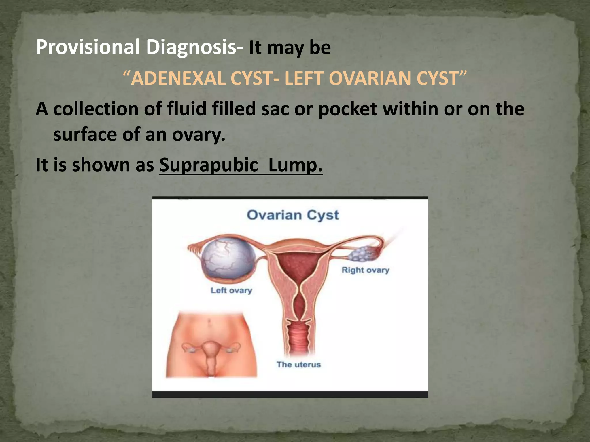 Case presentation on ovarian cyst obstetrics and gynaecology Adenexal ...